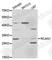 Regulator Of Calcineurin 1 antibody, A5326, ABclonal Technology, Western Blot image 