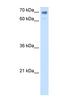 Calmegin antibody, NBP1-62547, Novus Biologicals, Western Blot image 