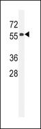 Coiled-Coil Domain Containing 85C antibody, PA5-24014, Invitrogen Antibodies, Western Blot image 