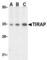 TIR Domain Containing Adaptor Protein antibody, AHP866, Bio-Rad (formerly AbD Serotec) , Western Blot image 
