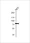 Hydroxyacyl-CoA Dehydrogenase Trifunctional Multienzyme Complex Subunit Alpha antibody, 62-519, ProSci, Western Blot image 