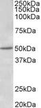 Estrogen Receptor 2 antibody, LS-C155027, Lifespan Biosciences, Western Blot image 