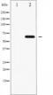 Fibroblast Growth Factor Receptor Substrate 2 antibody, abx010808, Abbexa, Western Blot image 