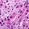 Tyrosinase antibody, LS-C352967, Lifespan Biosciences, Immunohistochemistry paraffin image 