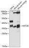 Methionine Adenosyltransferase 2B antibody, GTX64937, GeneTex, Western Blot image 