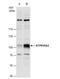 V-type proton ATPase 116 kDa subunit a isoform 2 antibody, NBP1-33018, Novus Biologicals, Western Blot image 