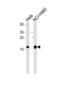 NME/NM23 Nucleoside Diphosphate Kinase 1 antibody, abx028433, Abbexa, Western Blot image 