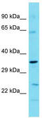 TBC1 Domain Family Member 7 antibody, TA345015, Origene, Western Blot image 