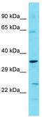 TBC1 Domain Family Member 7 antibody, TA345015, Origene, Western Blot image 