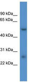 Phosphatidylinositol Glycan Anchor Biosynthesis Class W antibody, TA331010, Origene, Western Blot image 