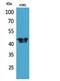 Branched Chain Amino Acid Transaminase 1 antibody, PA5-51116, Invitrogen Antibodies, Western Blot image 