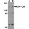 Regulatory Associated Protein Of MTOR Complex 1 antibody, LS-B579, Lifespan Biosciences, Western Blot image 