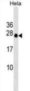 Dynactin Subunit 6 antibody, abx029713, Abbexa, Western Blot image 