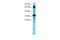 TGF-Beta Activated Kinase 1 (MAP3K7) Binding Protein 2 antibody, 27-585, ProSci, Immunohistochemistry paraffin image 