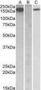 Colony Stimulating Factor 1 Receptor antibody, MBS422519, MyBioSource, Western Blot image 