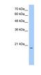 Dehydrogenase/Reductase 11 antibody, NBP1-60061, Novus Biologicals, Western Blot image 