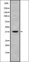 Olfactory Receptor Family 2 Subfamily T Member 5 antibody, orb337489, Biorbyt, Western Blot image 