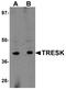 Potassium Two Pore Domain Channel Subfamily K Member 18 antibody, A07164, Boster Biological Technology, Western Blot image 