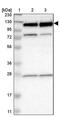 RNA Binding Motif Protein 5 antibody, PA5-53703, Invitrogen Antibodies, Western Blot image 