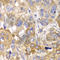 Protein Phosphatase 1 Catalytic Subunit Beta antibody, A1088, ABclonal Technology, Immunohistochemistry paraffin image 