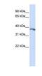 Ectodysplasin A antibody, NBP1-80537, Novus Biologicals, Western Blot image 