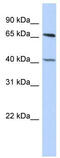 RB Binding Protein 5, Histone Lysine Methyltransferase Complex Subunit antibody, TA335726, Origene, Western Blot image 