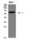 Parathyroid Hormone 1 Receptor antibody, STJ98966, St John