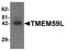 Transmembrane Protein 59 Like antibody, A15285, Boster Biological Technology, Western Blot image 