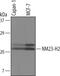 NME/NM23 Nucleoside Diphosphate Kinase 2 antibody, AF6665, R&D Systems, Western Blot image 