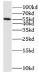 Protein Phosphatase 2 Regulatory Subunit B'Alpha antibody, FNab06722, FineTest, Western Blot image 