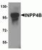 Inositol Polyphosphate-4-Phosphatase Type II B antibody, NBP2-82096, Novus Biologicals, Western Blot image 