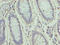 Zinc Finger Protein 555 antibody, LS-C394978, Lifespan Biosciences, Immunohistochemistry paraffin image 