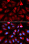 FKBP Prolyl Isomerase 4 antibody, 19-774, ProSci, Immunofluorescence image 
