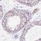 CDC Like Kinase 2 antibody, NBP2-47506, Novus Biologicals, Immunohistochemistry paraffin image 