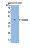 Plastin 3 antibody, LS-C304402, Lifespan Biosciences, Western Blot image 