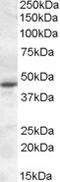 Melatonin Receptor 1A antibody, LS-C112831, Lifespan Biosciences, Western Blot image 