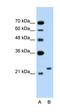 Ubiquitin Protein Ligase E3 Component N-Recognin 7 (Putative) antibody, orb325067, Biorbyt, Western Blot image 