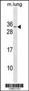 RNA Binding Motif Protein 7 antibody, 60-592, ProSci, Western Blot image 