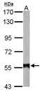 Aldehyde Dehydrogenase 2 Family Member antibody, NBP1-31749, Novus Biologicals, Western Blot image 