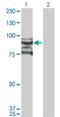 DNA Topoisomerase III Beta antibody, H00008940-M03, Novus Biologicals, Western Blot image 