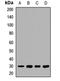 Microtubule Associated Protein RP/EB Family Member 1 antibody, LS-C667776, Lifespan Biosciences, Western Blot image 