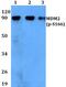 MDM2 Proto-Oncogene antibody, PA5-36740, Invitrogen Antibodies, Western Blot image 