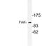 Protein Tyrosine Kinase 2 antibody, LS-C177635, Lifespan Biosciences, Western Blot image 