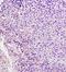 Platelet Derived Growth Factor Receptor Like antibody, orb11257, Biorbyt, Immunohistochemistry paraffin image 