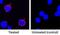 Interleukin 2 antibody, AF652, R&D Systems, Immunocytochemistry image 