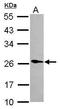Phospholipase A2 Group XIIA antibody, GTX117089, GeneTex, Western Blot image 