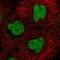 CXXC Finger Protein 5 antibody, PA5-66138, Invitrogen Antibodies, Immunofluorescence image 