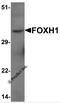 Forkhead Box H1 antibody, 7095, ProSci, Western Blot image 