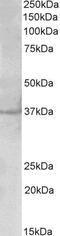 Polo Like Kinase 5 antibody, PA5-37987, Invitrogen Antibodies, Western Blot image 