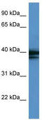 Heterogeneous Nuclear Ribonucleoprotein A/B antibody, TA345872, Origene, Western Blot image 